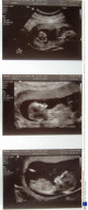 The family with two sets of black and white twins, Britain - 30 Dec 2008