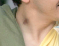 EXCLUSIVE Drew Barrymore gives Justin a huge hickey
