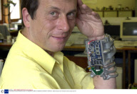 PROFESSOR KEVIN WARWICK AND HIS CYBERNETIC ARM AT READING UNIVERSITY, BRITAIN - 2002