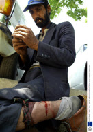 Crack addicts in Tehran, Iran - 2000s