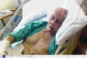 Great Train Robber Ronnie Biggs in hospital, Norwich, Norfolk, Britain - Jul 2009