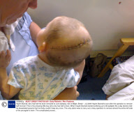 Haydn Boxhall, who had half his brain removed to cure epilepsy, Isle of Wight, Britain - Jul 2009
