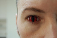 Eye-catching contact lenses by Hollywood special effects artist Kevin Carter, Medford, Oregon, America - 12 Jan 2010