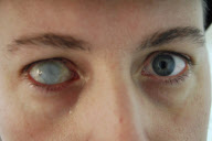 Eye-catching contact lenses by Hollywood special effects artist Kevin Carter, Medford, Oregon, America - 12 Jan 2010