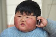 Obese two-year-old weighs as much as adult woman, Taocun town, Shanxi province, China - 02 Mar 2010