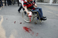 UDD nurses draw 1,000 litres of blood from red shirt demonstrators to splash it about the grounds of Government House, Bangkok, Thailand - 16 Mar 2010
