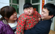 Obese two-year-old weighs as much as adult woman, Taocun town, Shanxi province, China - 06 Apr 2010