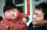 Obese two-year-old weighs as much as adult woman, Taocun town, Shanxi province, China - 06 Apr 2010