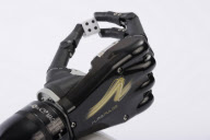 The i-LIMB Pulse prosthetic hand, Livingston, Scotland - 05 May 2010