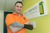 The i-LIMB Pulse prosthetic hand, Livingston, Scotland - 05 May 2010