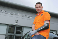 The i-LIMB Pulse prosthetic hand, Livingston, Scotland - 05 May 2010