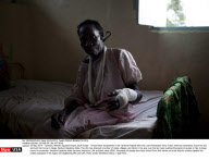SUDAN: VICTIMS OF LRA ATTACKS