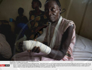 SUDAN: VICTIMS OF LRA ATTACKS
