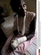SUDAN: VICTIMS OF LRA ATTACKS