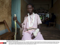 SUDAN: VICTIMS OF LRA ATTACKS