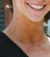 EXCLUSIVE Jennifer Love Hewitt with a snapple and a hickey?