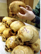 TUZLA: PATHOLOGY DEPARTEMENT: EXAMINATION OF VICTIMS FROM THE 1995 MASSACRE IN SREBR
