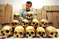 TUZLA: PATHOLOGY DEPARTEMENT: EXAMINATION OF VICTIMS FROM THE 1995 MASSACRE IN SREBR