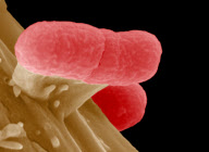 GERMANY-E. COLI-OUTBREAK