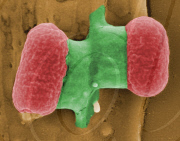 GERMANY-E. COLI-OUTBREAK