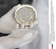 BERLIN: EHEC bacteria