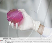 BERLIN: EHEC bacteria