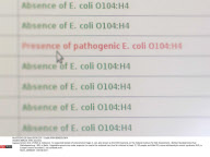 BERLIN: EHEC bacteria