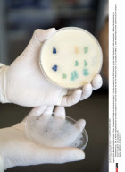 BERLIN: EHEC bacteria