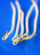 GERMANY-E.COLI OUTBREAK-BEAN SPROUTS