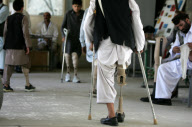 AFGHANISTAN-KABUL-ARTIFICIAL LIMB-MINES