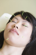 Chinese Medicine/acupuncture