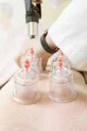 Chinese Medicine/acupuncture