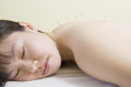 Chinese Medicine/acupuncture