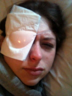 Woman almost suffers permanent eye damage by sleeping in contact lenses, Norwich, Norfolk, Britain - 26 Jul 2011