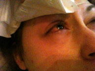 Woman almost suffers permanent eye damage by sleeping in contact lenses, Norwich, Norfolk, Britain - 26 Jul 2011