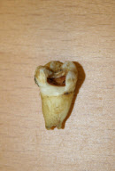 John Lennon's Tooth Up For Auction, Stockport, Greater Manchester - Oct 2011