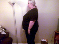 Schlank durch Magenband: Laura Turner aus Haverhill verliert nach zwei Jahren die Hälfte ihres Körpergewichts