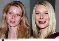 Celebs Nose Jobs - Have They or Haven't They?