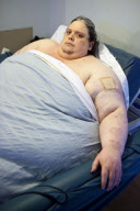Keith Martin - Der dickste Mann der Welt?