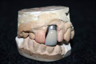 THE KING'S CROWN ¿ A model of Elvis Presley's teeth together with a crown made for the star by former Memphis dentist Henry J Weiss, up for auction on 25th February, Cheshire, Britain  - 15 Feb 2012