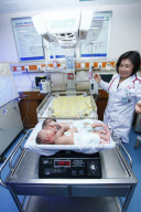  CHINA CHANGSHA CONJOINED TWINS SEPARATION 