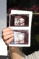 Molly Sims shows off her Baby Sonogram to her girlfriends