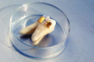 Tooth tattoos can tell when your ill, Princeton, America - Apr 2012