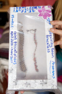 "Tödliches Armband": Britin (40) kämpft mit schweren Vergiftungserscheinungen