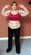 Women left with rolls of excess skin claims she felt happier and sexier before losing 11st, Bexley, London, Britain - 20 Feb 2012