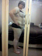 Women left with rolls of excess skin claims she felt happier and sexier before losing 11st, Bexley, London, Britain - 20 Feb 2012