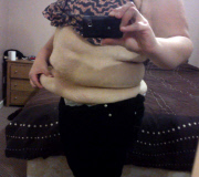 Women left with rolls of excess skin claims she felt happier and sexier before losing 11st, Bexley, London, Britain - 20 Feb 2012