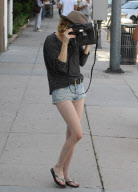 Emma Roberts has a black eye?!