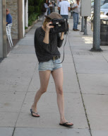 Emma Roberts has a black eye?!