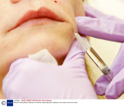 Woman having Botex injections